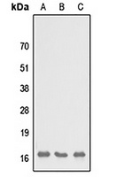 SH3BGRL3 Rabbit Polyclonal Antibody