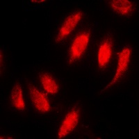 SMAD2 (Phospho-S467) Rabbit Polyclonal Antibody