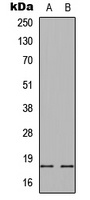 Alpha-synuclein (Phospho-S129) Rabbit Polyclonal Antibody