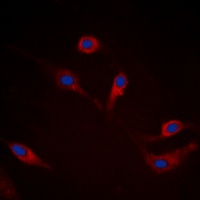 Alpha-synuclein (Phospho-S129) Rabbit Polyclonal Antibody