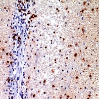 Alpha-synuclein Rabbit Polyclonal Antibody