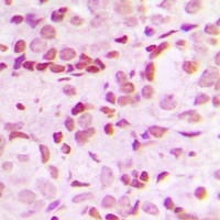SP1 (Phospho-T453) Rabbit Polyclonal Antibody