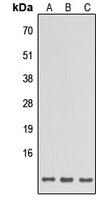 SPINK6 Rabbit Polyclonal Antibody