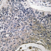 SPINK6 Rabbit Polyclonal Antibody
