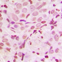 SRF (Phospho-S103) Rabbit Polyclonal Antibody