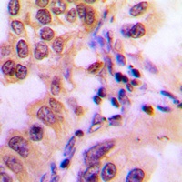 STAT2 (Phospho-Y690) Rabbit Polyclonal Antibody