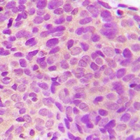 MST3 Rabbit Polyclonal Antibody
