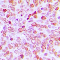 TBP Rabbit Polyclonal Antibody