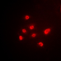 TBP Rabbit Polyclonal Antibody