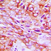 TMBIM1 Rabbit Polyclonal Antibody