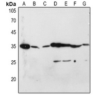 CD253 Rabbit Polyclonal Antibody