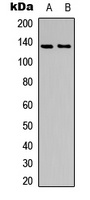 ACK1 (Phospho-Y284) Rabbit Polyclonal Antibody