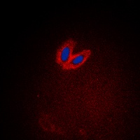 ACK1 (Phospho-Y284) Rabbit Polyclonal Antibody