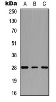 cTnI Rabbit Polyclonal Antibody