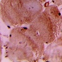 cTnI Rabbit Polyclonal Antibody