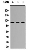 CARK Rabbit Polyclonal Antibody