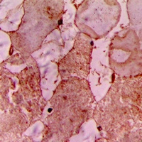 CARK Rabbit Polyclonal Antibody