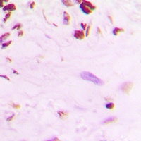 p53 (Phospho-S392) Rabbit Polyclonal Antibody