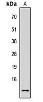 Fusion 1 Rabbit Polyclonal Antibody