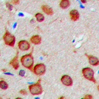 Fusion 1 Rabbit Polyclonal Antibody