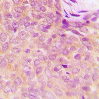 UBA5 Rabbit Polyclonal Antibody