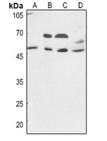 VIPR1 Rabbit Polyclonal Antibody