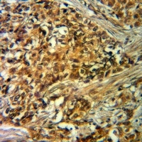 VIPR1 Rabbit Polyclonal Antibody