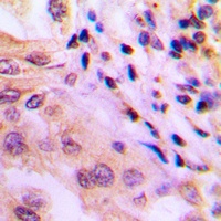 WNK1 (Phospho-T60) Rabbit Polyclonal Antibody