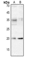 XCL1 Rabbit Polyclonal Antibody