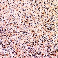XCL1 Rabbit Polyclonal Antibody