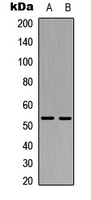 XIAP Rabbit Polyclonal Antibody