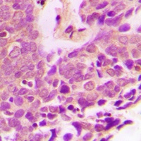 XIAP Rabbit Polyclonal Antibody