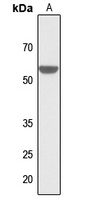ZIC1/2/3/4/5 Rabbit Polyclonal Antibody