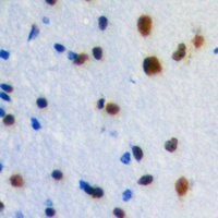 ZIC1/2/3 Rabbit Polyclonal Antibody