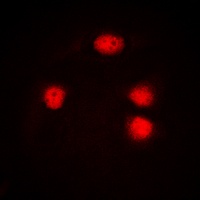 ZIC1/2/3 Rabbit Polyclonal Antibody
