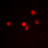 RACK7 Rabbit Polyclonal Antibody