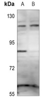 ZNF148 Rabbit Polyclonal Antibody