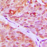 ZNF148 Rabbit Polyclonal Antibody
