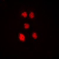 ZNF148 Rabbit Polyclonal Antibody