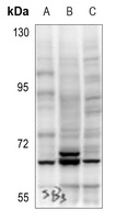 AKT (Phospho-S473) Rabbit Polyclonal Antibody