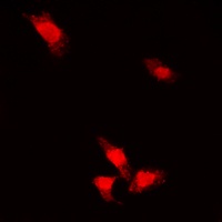 AKT (Phospho-S473) Rabbit Polyclonal Antibody
