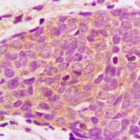 PRAS40 Rabbit Polyclonal Antibody