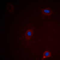 Ataxin 1 (Phospho-S775) Rabbit Polyclonal Antibody