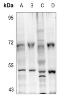 Aurora A (Phospho-T288) Rabbit Polyclonal Antibody