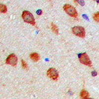 Aurora A (Phospho-T288) Rabbit Polyclonal Antibody