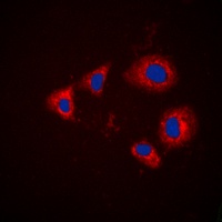 Aurora A (Phospho-T288) Rabbit Polyclonal Antibody