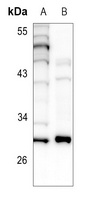 BCL2 Rabbit Polyclonal Antibody