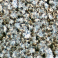 BCL2 Rabbit Polyclonal Antibody