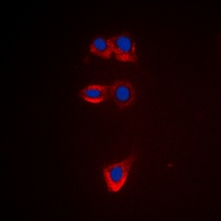 BCL2 Rabbit Polyclonal Antibody