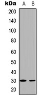 BCLX (Phospho-T47) Rabbit Polyclonal Antibody